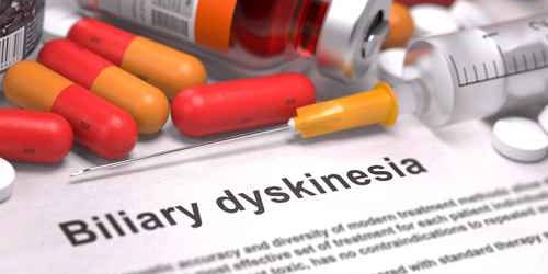 Biliary Dyskinesia by Dr. Iraniha