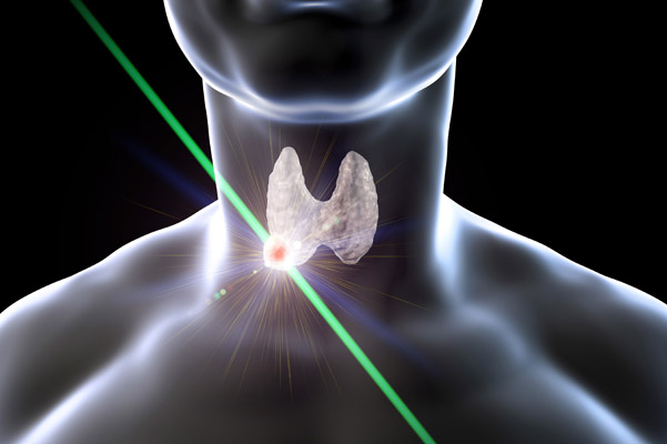 Thyroidectomy