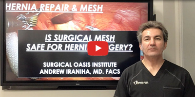 Is surgical mesh safe for hernia surgery by Dr. Iraniha