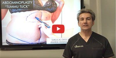 What is the tummy tuck surgery by Dr. Iraniha