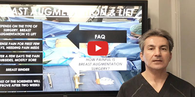 FAQ about breast augmentation by Dr. Iraniha