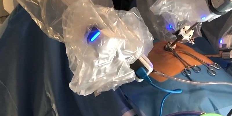 Dr. Iraniha performing robotic inguinal hernia repair Dr. Iraniha performing robotic inguinal hernia repair - Surgical Oasis Institute