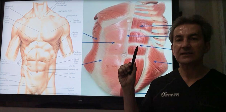 What are the surgical options to repair the diastasis recti by Dr. Iraniha