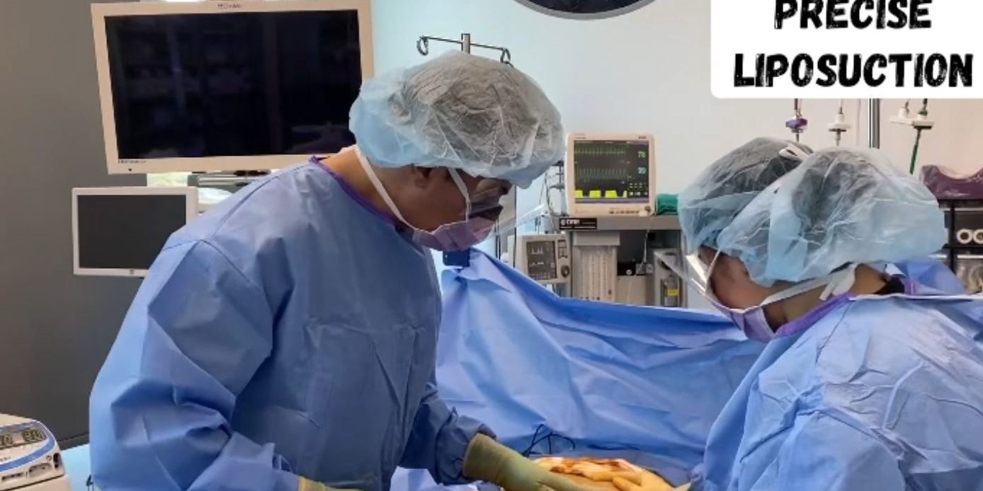 What is Liposuction or Lipo Sculpture What is Liposuction or Lipo Sculpture by Dr. Iraniha