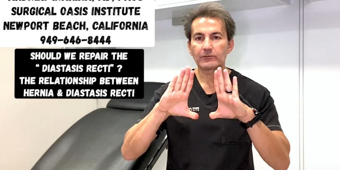 Dr. Iraniha Should we repair the Diastasis Recti - Surgical Oasis Institute