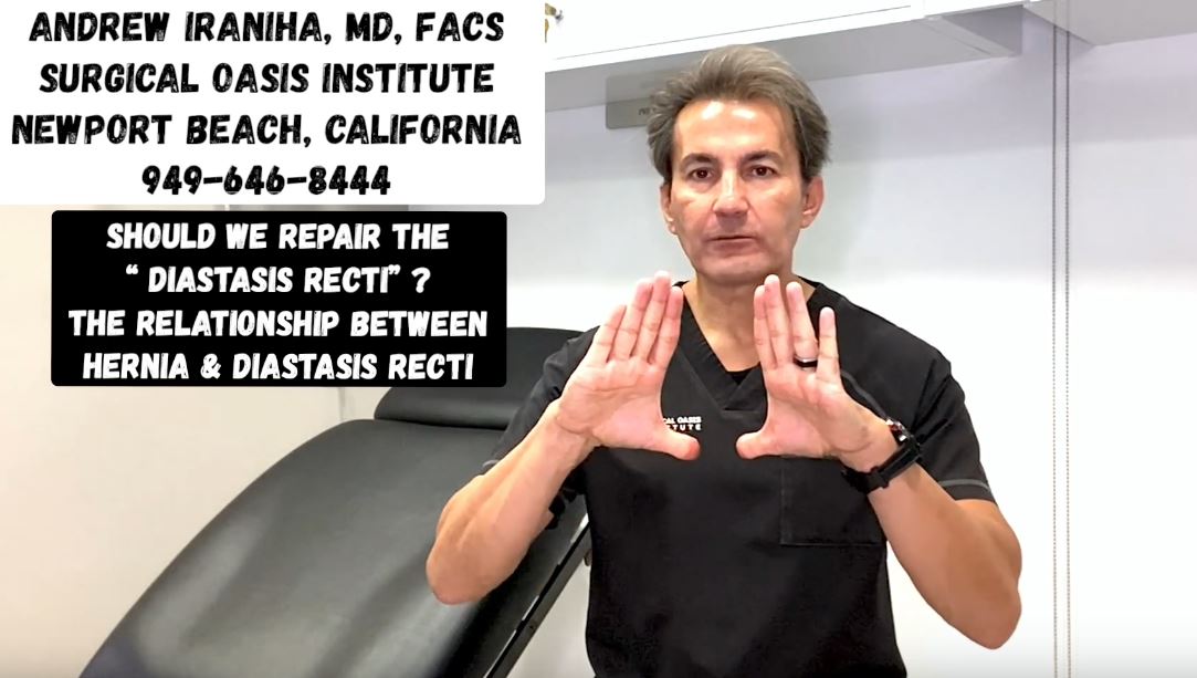 Dr. Iraniha Should we repair the Diastasis Recti