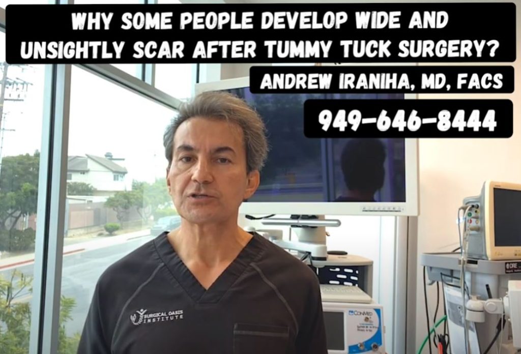 Why some people develop wide and unsightly scar after tummy tuck surgery by Dr. Iraniha