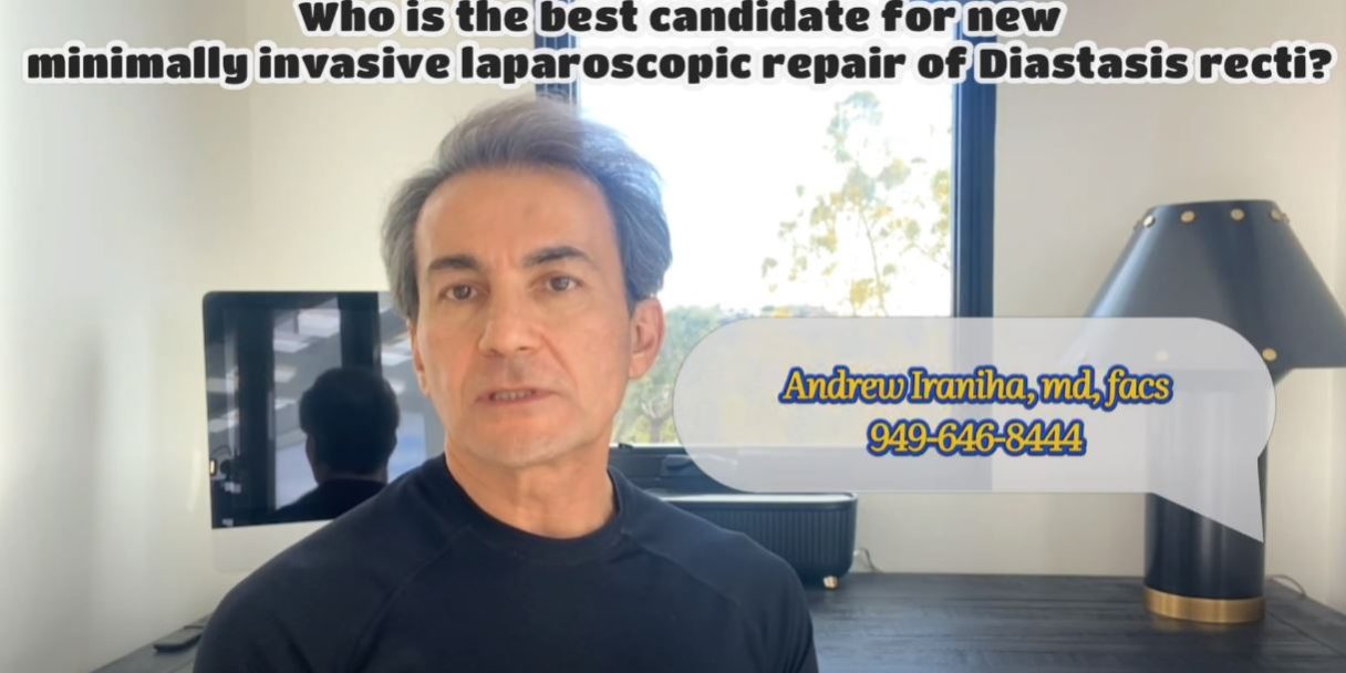 Who is the best candidate for new minimally invasive laparoscopic repair of Diastasis Recti by Dr. Iraniha