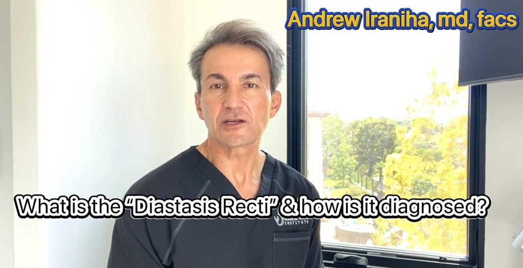 What is Diastasis Recti and how is it diagnosed by Dr. Iraniha