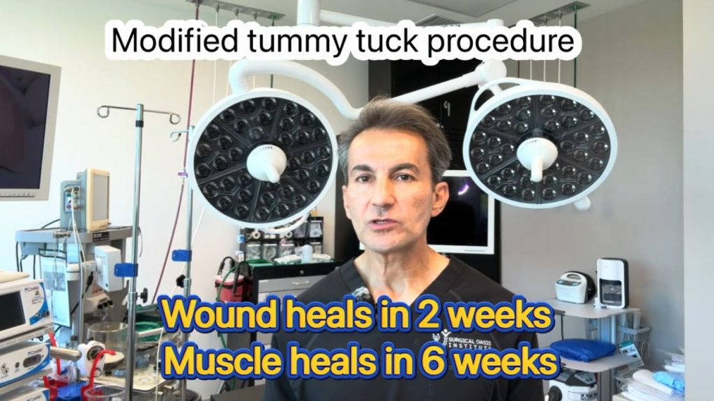 Recovery after modified tummy tuck surgery by Dr. Iraniha