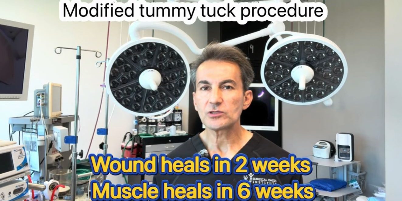 Recovery after modified tummy tuck surgery by Dr. Iraniha